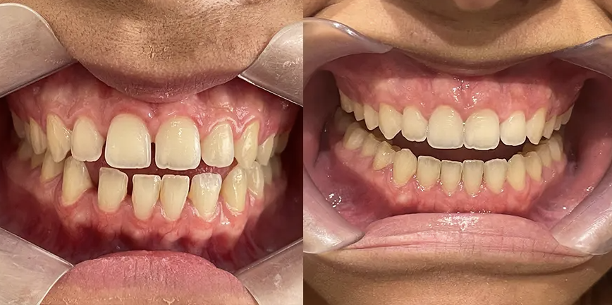 Amanda C. I 26 Etapas