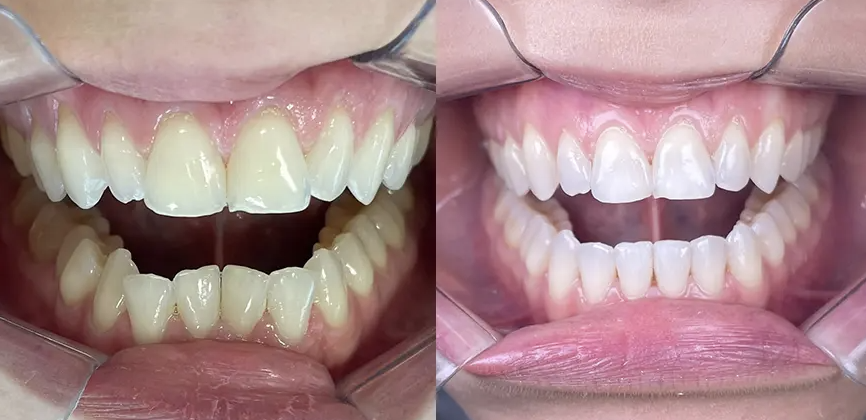 Camila F. I 15 Etapas