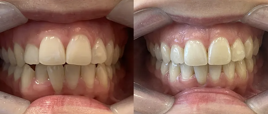 Gabriela M. I 28 Etapas