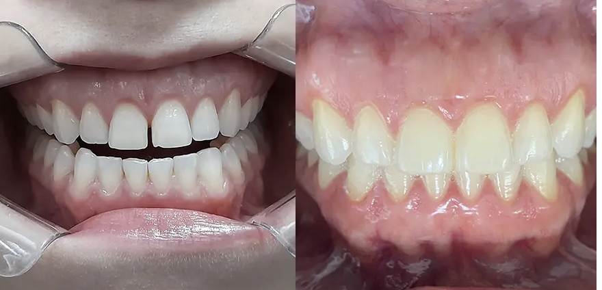 Jessika Y. I 12 Etapas