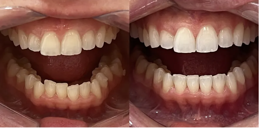 Nathália A. I 20 Etapas